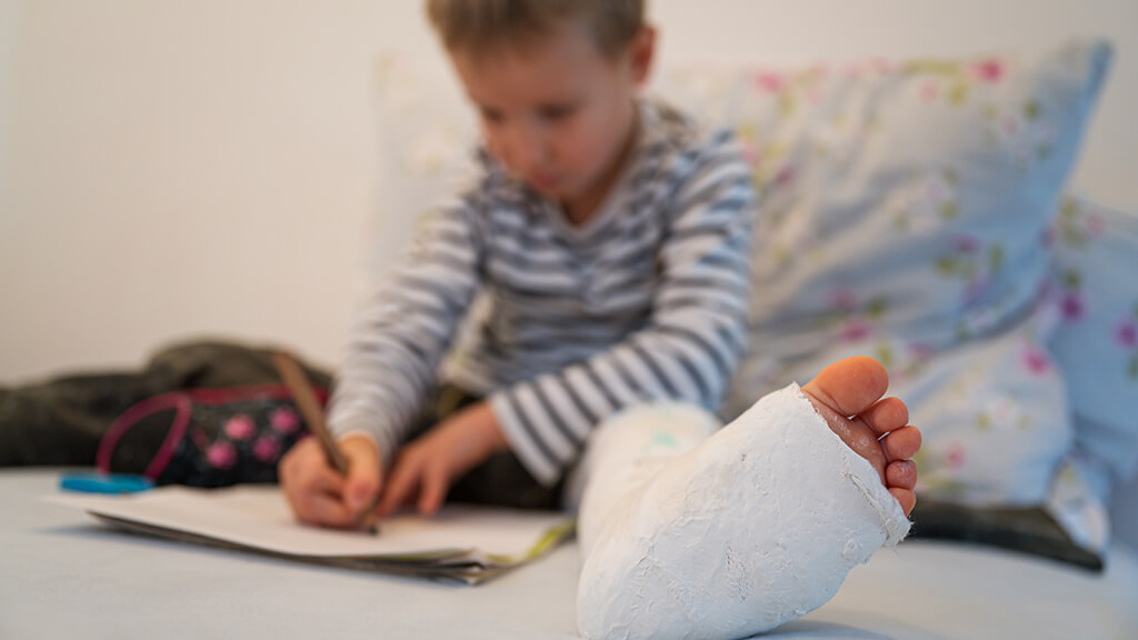 Jeune enfant avec une jambe dans le plâtre